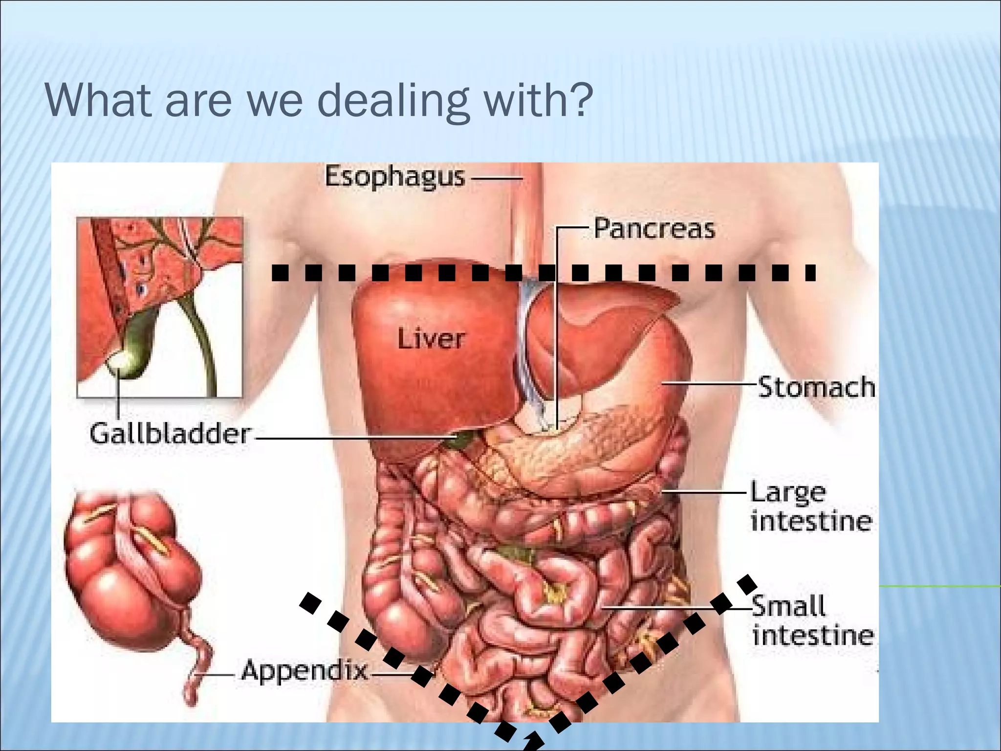 Laparostomy management - ABThera™ Open Abdomen Negative Pressure ...
