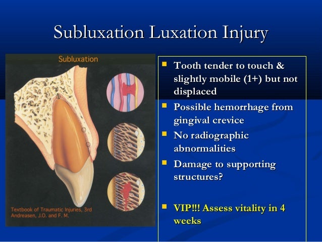 dental trauma tooth luxation