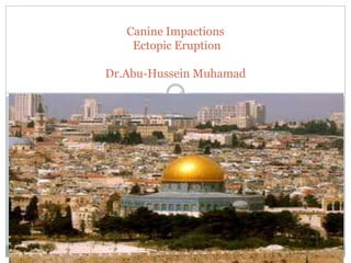 Canine Impactions
Ectopic Eruption
Dr.Abu-Hussein Muhamad
1
 
