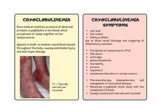 Complement Deposit Rash Abundez Hernandez Diana_FLASHCARDS DERMA .pdf