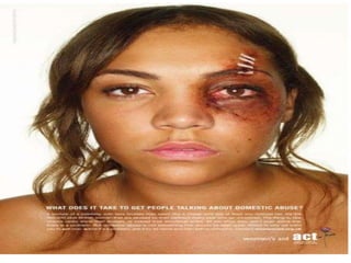 Suspicious Fractures