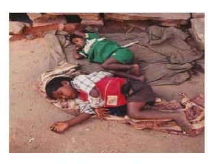 Injuries to the sides of the face, ears, cheeks, and temple area are highly suspicious for abuse.