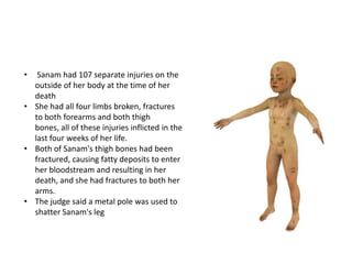 He died from a killer punch in the face, swallowing a knocked-out tooth. There were more than 50 injuries including 15 to his mouth.