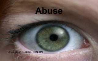 Abuse



Aries Glenn B. Galao, BSN, RN
 