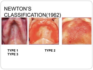 Abused tissue management | PPTX