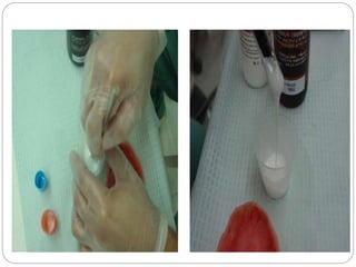 Abused tissue management | PPTX