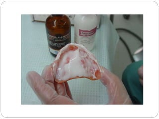 Abused tissue management | PPTX