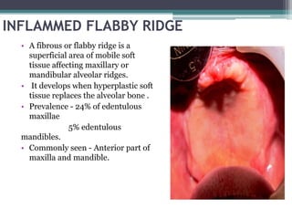 Tissue Ridges Abused tissue management 2 | PPTX