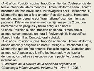 •A) 6 años. Posición supina, tracción en tienda. Coalescencia de
tercio inferior de labios menores. Himen falciforme sano. Cicatriz
nacarada en fosa navicularis. Vulvovaginitis por H. influenzae. B)
Misma niña que en la foto anterior. Posición supina. Hematoma
en labio mayor derecho por “traumatismo” ocurrido mientras
patinaba. Dilatación anal asimétrica, fija, mayor de 2 cm. con
borramiento de pliegues y fisura antigua en hora 6.
•8 años. Posición supina, tracción en tienda. Himen anular
asimétrico con muesca en hora 6. Vulvovaginitis inespecífica.
Abuso intrafamiliar. Contacto oral y digital.
•A) 6 años. Posición supina, tracción en tienda. Himen falciforme,
orificio amplio y desgarro en hora 6. Vitiligo. C. trachomatis. B)
Misma niña que en foto anterior. Posición supina. Dilatación anal
asimétrica. A pesar que la niña fue internada y se hizo la
denuncia, los padres se escapan con la paciente durante la
internación.
“Extractado de la Revista de la Sociedad Argentina de
Ginecología Infanto Juvenil. Volumen VI – Nro. 1- 1999. “
 