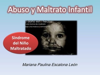 Mariana Paulina Escalona León 
Síndrome del Niño Maltratado  