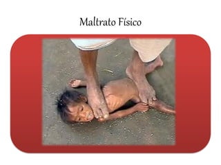 Maltrato Físico 
•Agresiones físicas directas sobre el niño, que ocasionaran lesiones tangibles como: Provocando secuelas tanto físicas como emocionales 
Equimosis 
Quemaduras 
Fracturas 
Laceraciones o daño en órganos internos 
¿A la exploración?  