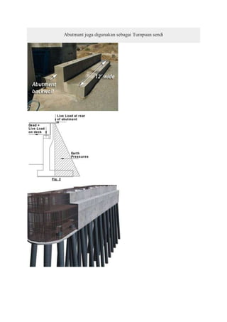 Abutmant juga digunakan sebagai Tumpuan sendi
 