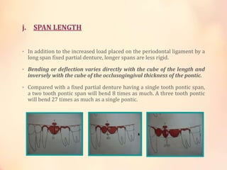 j. SPAN LENGTH
• In addition to the increased load placed on the periodontal ligament by a
long span fixed partial denture...