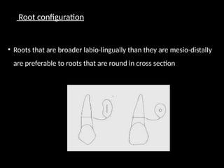 Root configuration
• Roots that are broader labio-lingually than they are mesio-distalIy
are preferable to roots that are round in cross section
 