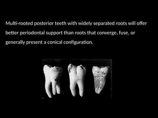 Multi-rooted posterior teeth with widely separated roots will offer
better periodontal support than roots that converge, fuse, or
generally present a conical configuration.
 