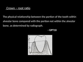 Crown – root ratio
The physical relationship between the portion of the tooth within
alveolar bone compared with the portion not within the alveolar
bone, as determined by radiograph.
- GPT10
 