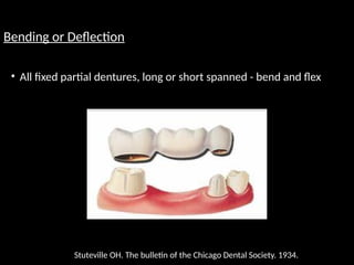 Bending or Deflection
• All fixed partial dentures, long or short spanned - bend and flex
Stuteville OH. The bulletin of the Chicago Dental Society. 1934.
 