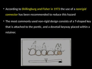 • According to Shillingburg and Fisher in 1973 the use of a nonrigid
connector has been recommended to reduce this hazard
• The most commonly used non-rigid design consists of a T-shaped key
that is attached to the pontic, and a dovetail keyway placed within a
retainer.
 