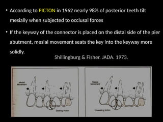 • According to PICTON in 1962 nearly 98% of posterior teeth tilt
mesially when subjected to occlusal forces
• If the keyway of the connector is placed on the distal side of the pier
abutment, mesial movement seats the key into the keyway more
solidly.
Shillingburg & Fisher. JADA. 1973.
 