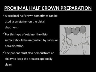 A proximal half crown sometimes can be
used as a retainer on the distal
abutment.
For this type of retainer the distal
surface should be untouched by caries or
decalcification.
The patient must also demonstrate an
ability to keep the area exceptionally
clean.
PROXIMAL HALF CROWN PREPARATION
 