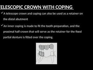 :-
A telescope crown and coping can also be used as a retainer on
the distal abutment
An inner coping is made to fit the tooth preparation, and the
proximal half crown that will serve as the retainer for the fixed
partial denture is fitted over the coping.
TELESCOPIC CROWN WITH COPING
 