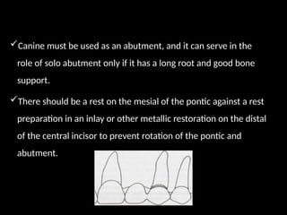 Canine must be used as an abutment, and it can serve in the
role of solo abutment only if it has a long root and good bone
support.
There should be a rest on the mesial of the pontic against a rest
preparation in an inlay or other metallic restoration on the distal
of the central incisor to prevent rotation of the pontic and
abutment.
 