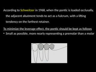 According to Schweitzer in 1968, when the pontic is loaded occlusally,
the adjacent abutment tends to act as a fulcrum, with a lifting
tendency on the farthest retainer.
To minimize the leverage effect, the pontic should be kept as follows
• Small as possible, more nearly representing a premolar than a molar
 