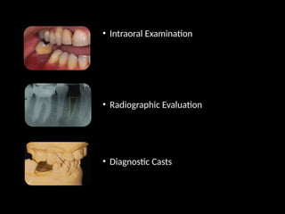 • Intraoral Examination
• Radiographic Evaluation
• Diagnostic Casts
 