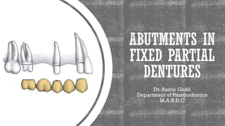 ABUTMENTS IN
FIXED PARTIAL
DENTURES
Dr. Aamir Godil
Department of Prosthodontics
M.A.R.D.C
 