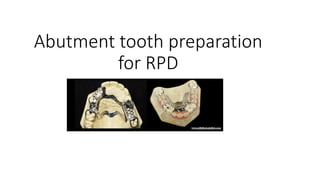 Abutment tooth preparation
for RPD
 