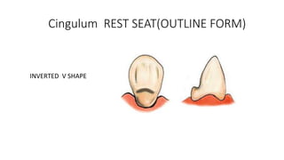 abutment tooth prep part 2.pptx