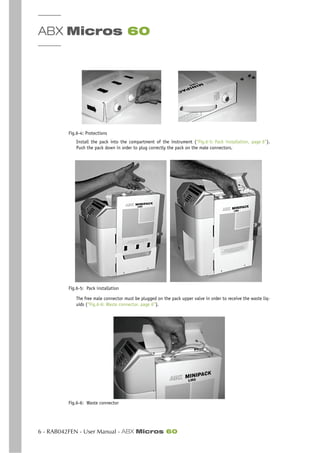 ABX Micros 60
6 - RAB042FEN - User Manual - ABX Micros 60
Fig.6-4: Protections
Install the pack into the compartment of the instrument (“Fig.6-5: Pack installation, page 6”).
Push the pack down in order to plug correctly the pack on the male connectors.
Fig.6-5: Pack installation
The free male connector must be plugged on the pack upper valve in order to receive the waste liq-
uids (“Fig.6-6: Waste connector, page 6”).
Fig.6-6: Waste connector
 