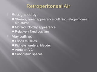  Recognised by:
 Streaky, linear appearance outlining retroperitoneal
structures
 Mottled, blotchy appearance
 Relatively fixed position
 May outline:
 Psoas muscles
 Kidneys, ureters, bladder
 Aorta or IVC
 Subphrenic spaces
 