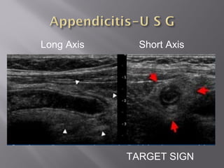 Long Axis Short Axis
TARGET SIGN
 