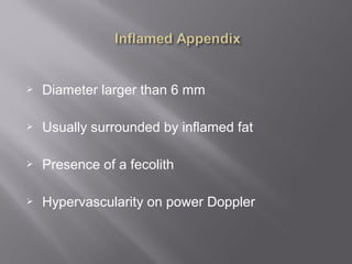  Diameter larger than 6 mm
 Usually surrounded by inflamed fat
 Presence of a fecolith
 Hypervascularity on power Doppler
 