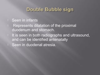 Seen in infants
 Represents dilatation of the proximal
duodenum and stomach.
 It is seen in both radiographs and ultrasound,
and can be identified antenatally
 Seen in duodenal atresia.
 