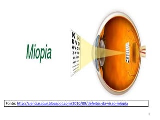Fonte: http://cienciasaqui.blogspot.com/2010/09/defeitos-da-visao-miopia
12
 
