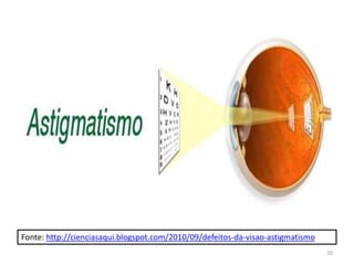 Fonte: http://cienciasaqui.blogspot.com/2010/09/defeitos-da-visao-astigmatismo
20
 