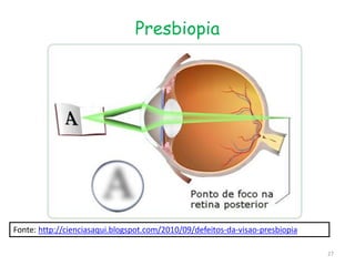 Presbiopia
Fonte: http://cienciasaqui.blogspot.com/2010/09/defeitos-da-visao-presbiopia
27
 