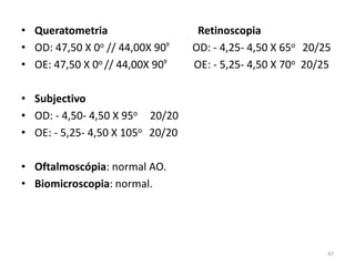• Queratometria Retinoscopia
• OD: 47,50 X 0o // 44,00X 90º OD: - 4,25- 4,50 X 65o 20/25
• OE: 47,50 X 0o // 44,00X 90º OE: - 5,25- 4,50 X 70o 20/25
• Subjectivo
• OD: - 4,50- 4,50 X 95o 20/20
• OE: - 5,25- 4,50 X 105o 20/20
• Oftalmoscópia: normal AO.
• Biomicroscopia: normal.
47
 