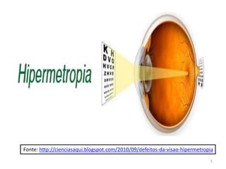 Fonte: http://cienciasaqui.blogspot.com/2010/09/defeitos-da-visao-hipermetropia
5
 