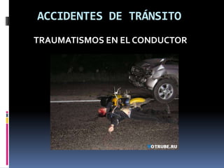 ACCIDENTES DE TRÁNSITO
TRAUMATISMOS EN EL CONDUCTOR
 