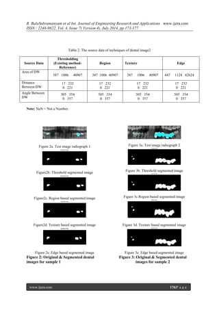 Different Image Segmentation Techniques for Dental Image Extraction | PDF