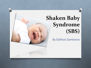 Shaken	Baby	
Syndrome	
(SBS)	
By Edithce Zambrano
 