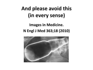And please avoid this
(in every sense)
Images in Medicine.
N Engl J Med 363;18 (2010)
 