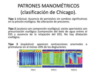 PATRONES MANOMÉTRICOS
(clasificación de Chicago).
Tipo 1 (clásica): Ausencia de peristalsis sin cambios significativos
en la presión esofágica. No alteración de presiones.
Tipo 2 (acalasia con compresión esofágica): existe aperistalsis con
presurización esofágica (compresión del bolo de agua entres el
EES y ausencia de la relajación del EEI). No hay dilatación
esofágica.
Tipo 3 (espástica): aparecen contracciones anormales o
prematuras en al menos 20% de las degluciones.
 