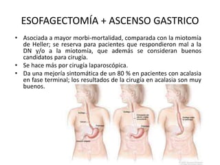 ESOFAGECTOMÍA + ASCENSO GASTRICO
• Asociada a mayor morbi-mortalidad, comparada con la miotomía
de Heller; se reserva para pacientes que respondieron mal a la
DN y/o a la miotomía, que además se consideran buenos
candidatos para cirugía.
• Se hace más por cirugía laparoscópica.
• Da una mejoría sintomática de un 80 % en pacientes con acalasia
en fase terminal; los resultados de la cirugía en acalasia son muy
buenos.
 