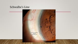 Schwalbe’s Line
 