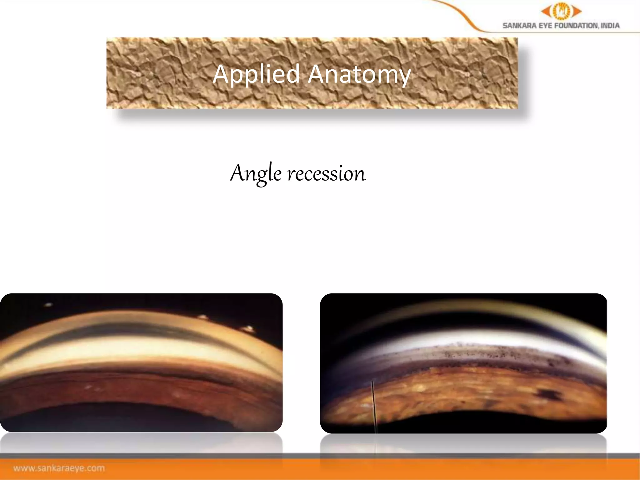 Anatomy of the anterior chamber and angle | PPTX