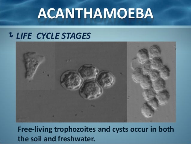 Acanthamoeba